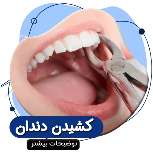 کشیدن دندان 50494949