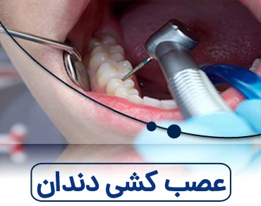 عصب کشی دندان 6540884849