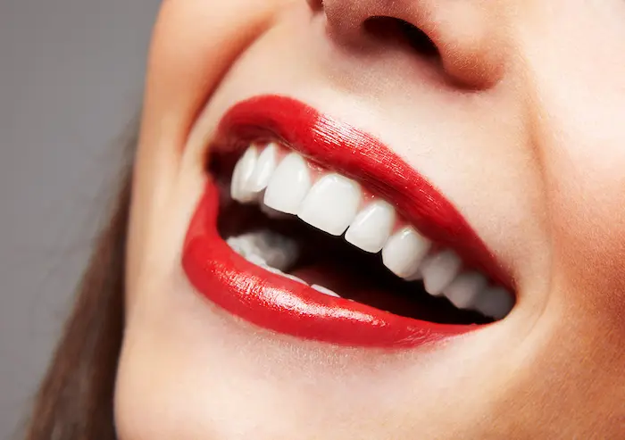جرم گیری دندان چیست؟، لبخند خانمی با دندان های بدون جرم