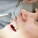 جرم گیری دندان چیست؟| فواید+روشها+مراحل+معایب