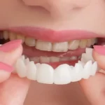 با انواع روکش دندان آشنا شوید و بهترین نوع آن را بشناسید