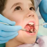 عصب کشی دندان چیست؟| تمام اطلاعات عصب‌کشی دندان