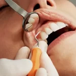 تمام روش‌های نوین ترمیم دندان در گرگان+معرفی بهترین روش