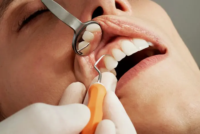 روش های نوین ترمیم دندان، بررسی دندان با اینومر توسط پزشک