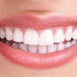 تاثیر دیابت بر دهان و دندان | روش های مراقبت از دندان افراد دیابتی