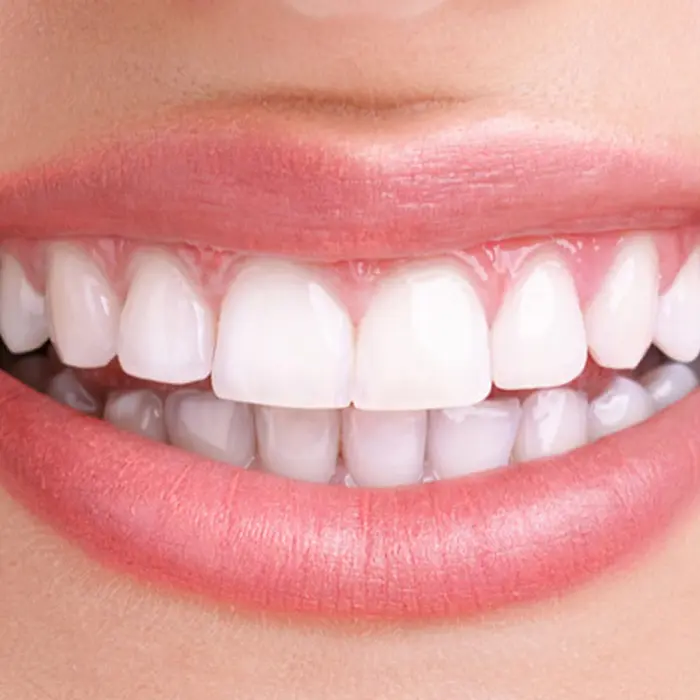دندان سفید وسالم 655645458