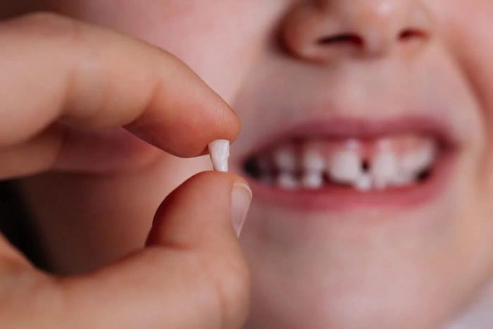 دندان شیری افتاده پسر بچه 62652566