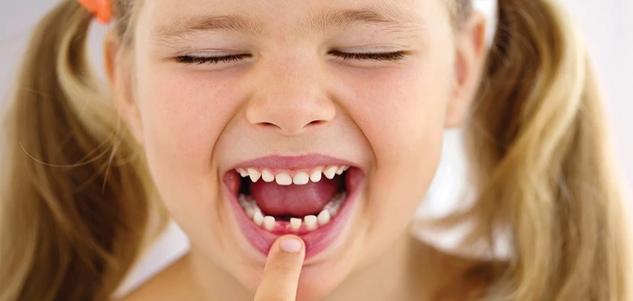 دندان شیری افتاده دختر بچه 5341514