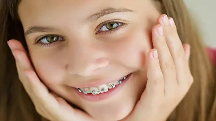 دندان ارتودنسی شده کودک 4541