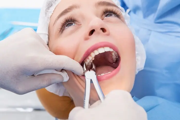 معاینه پزشک برای دندان عقل نهفته 1536416874
