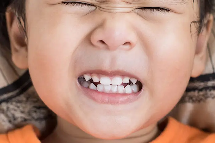 دندان قروچه در کودکان 1564787
