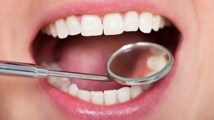 دندان قروچه در بزرگسالان 566464967