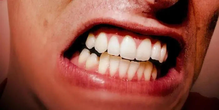 دندان قروچه در مردان 1564864