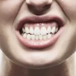 دندان قروچه چیست؟ | علائم | علت های مختلف | درمان خانگی | راه های پیشگیری