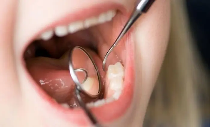 بررسی دندان های بیمار توسط دندان پزشک 4648