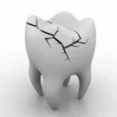 ترک مویی دندان چیست؟ 🦷| علت ⭕| علائم ⚠️| درمان 🩺| نکات مهم ✅
