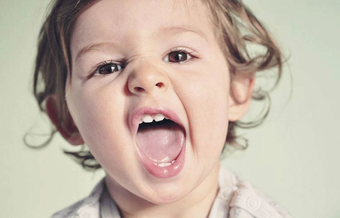 دلایل سیاه شدن دندان کودکان چیست؟ 41684736874
